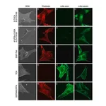 Merck Monoclonal Anti-β-Tubulin antibody produced in mouse