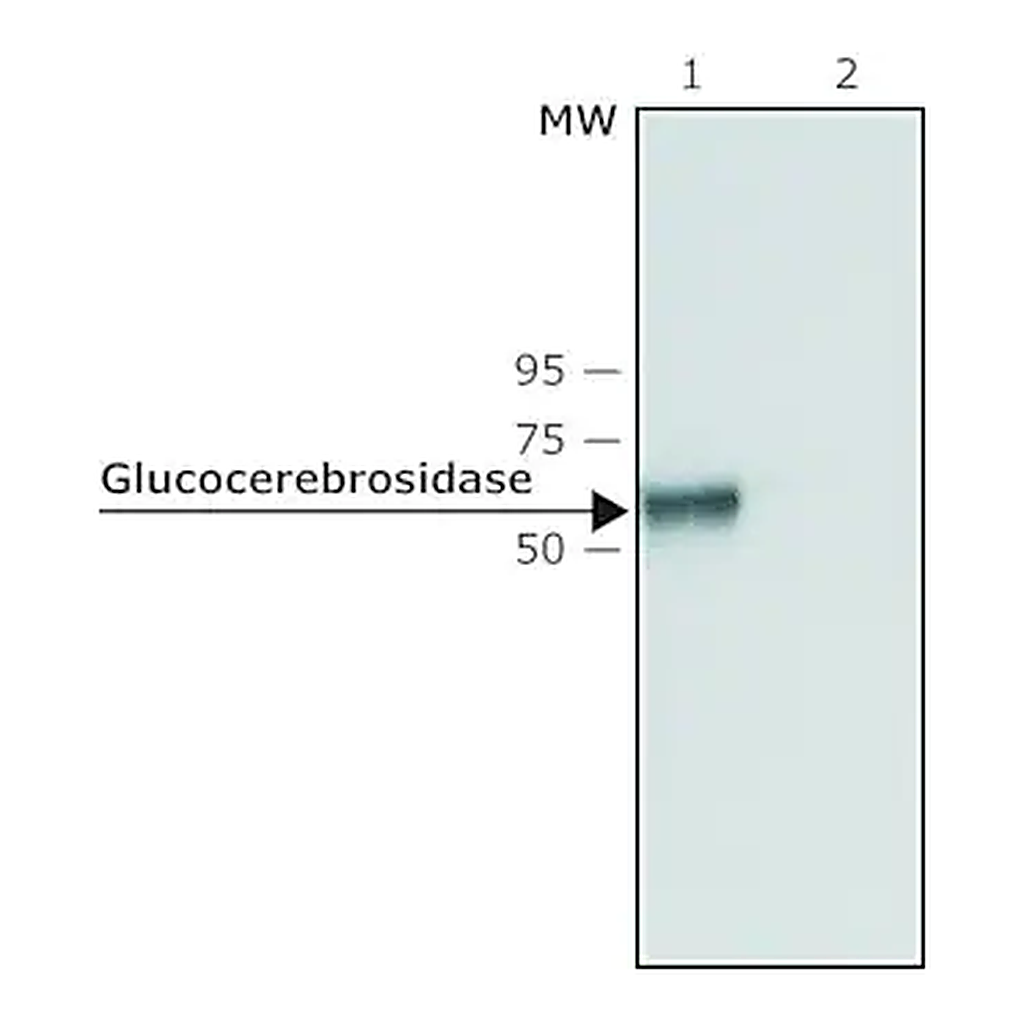 Merck Anti-Glucocerebrosidase (C-terminal) antibody produced in rabbit