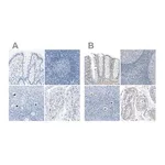 Merck Anti-SALL4 antibody produced in rabbit