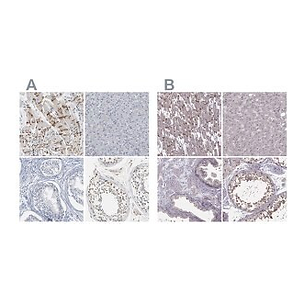 Merck Anti-PKP2 antibody produced in rabbit