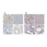 Merck Anti-PKP2 antibody produced in rabbit