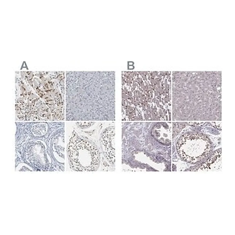 Merck Anti-PKP2 antibody produced in rabbit