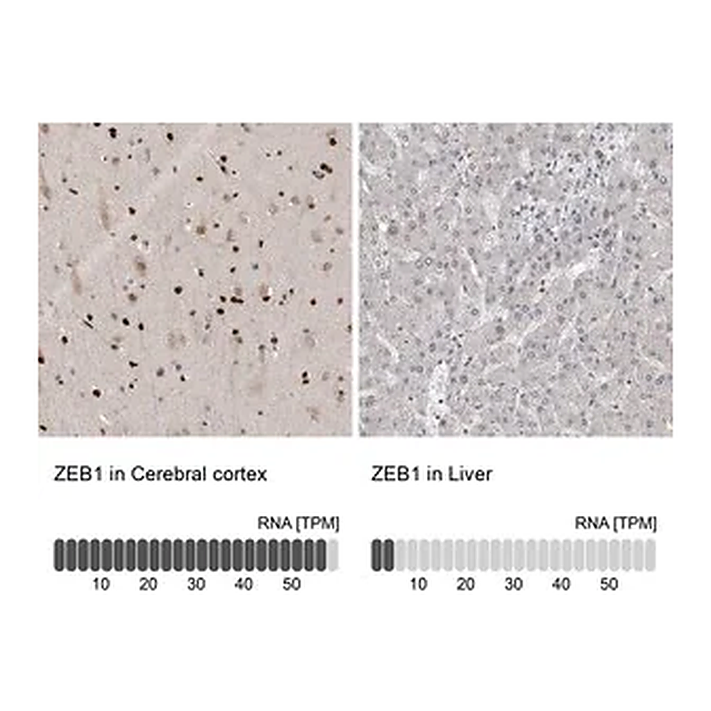 Merck Anti-ZEB1 antibody produced in rabbit