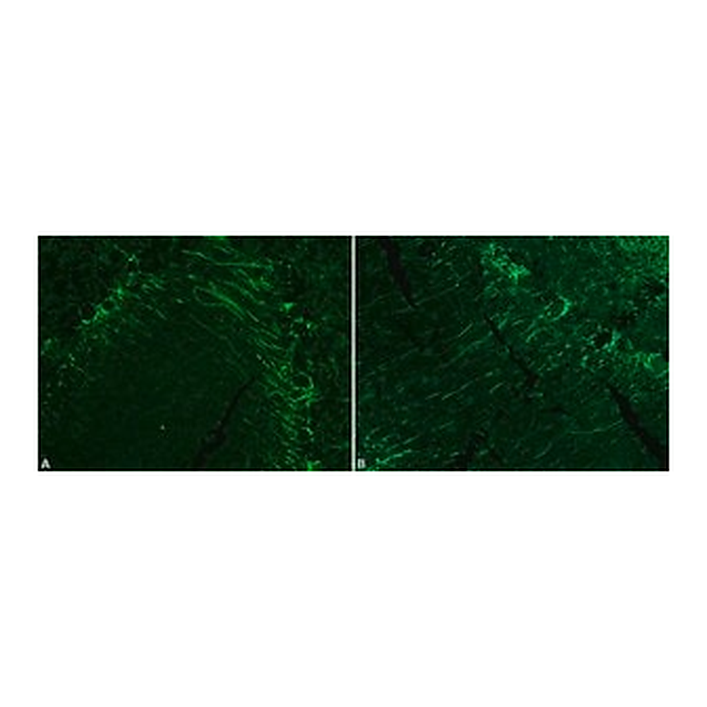 Merck Monoclonal Anti-Neurofilament 200 antibody produced in mouse
