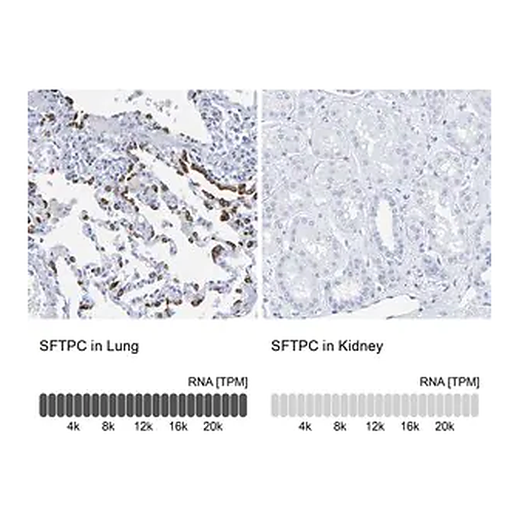 Merck Anti-SFTPC antibody produced in rabbit