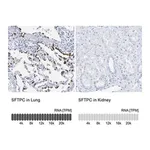 Merck Anti-SFTPC antibody produced in rabbit