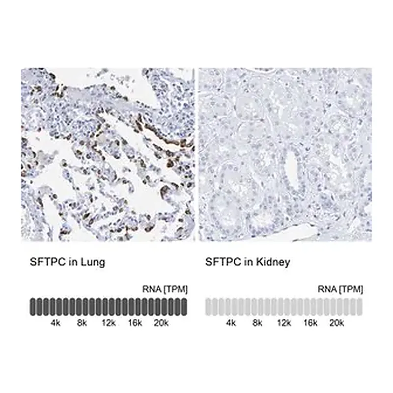 Merck Anti-SFTPC antibody produced in rabbit