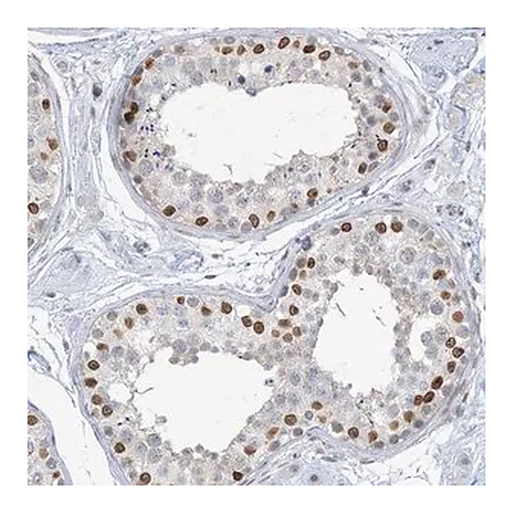Merck Anti-KMT2D antibody produced in rabbit