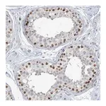 Merck Anti-KMT2D antibody produced in rabbit