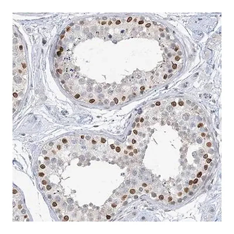 Merck Anti-KMT2D antibody produced in rabbit