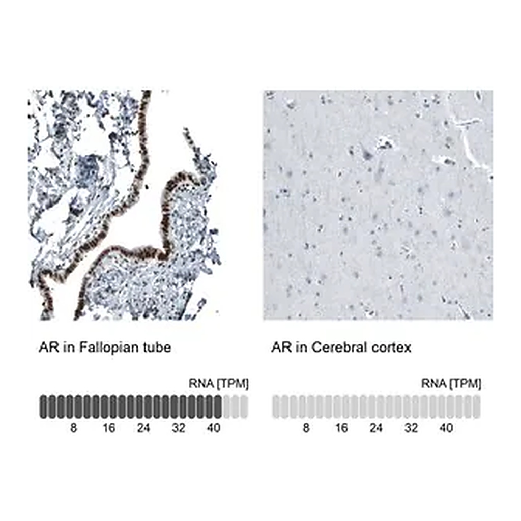 Merck Monoclonal Anti-AR antibody produced in mouse