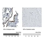 Merck Monoclonal Anti-AR antibody produced in mouse