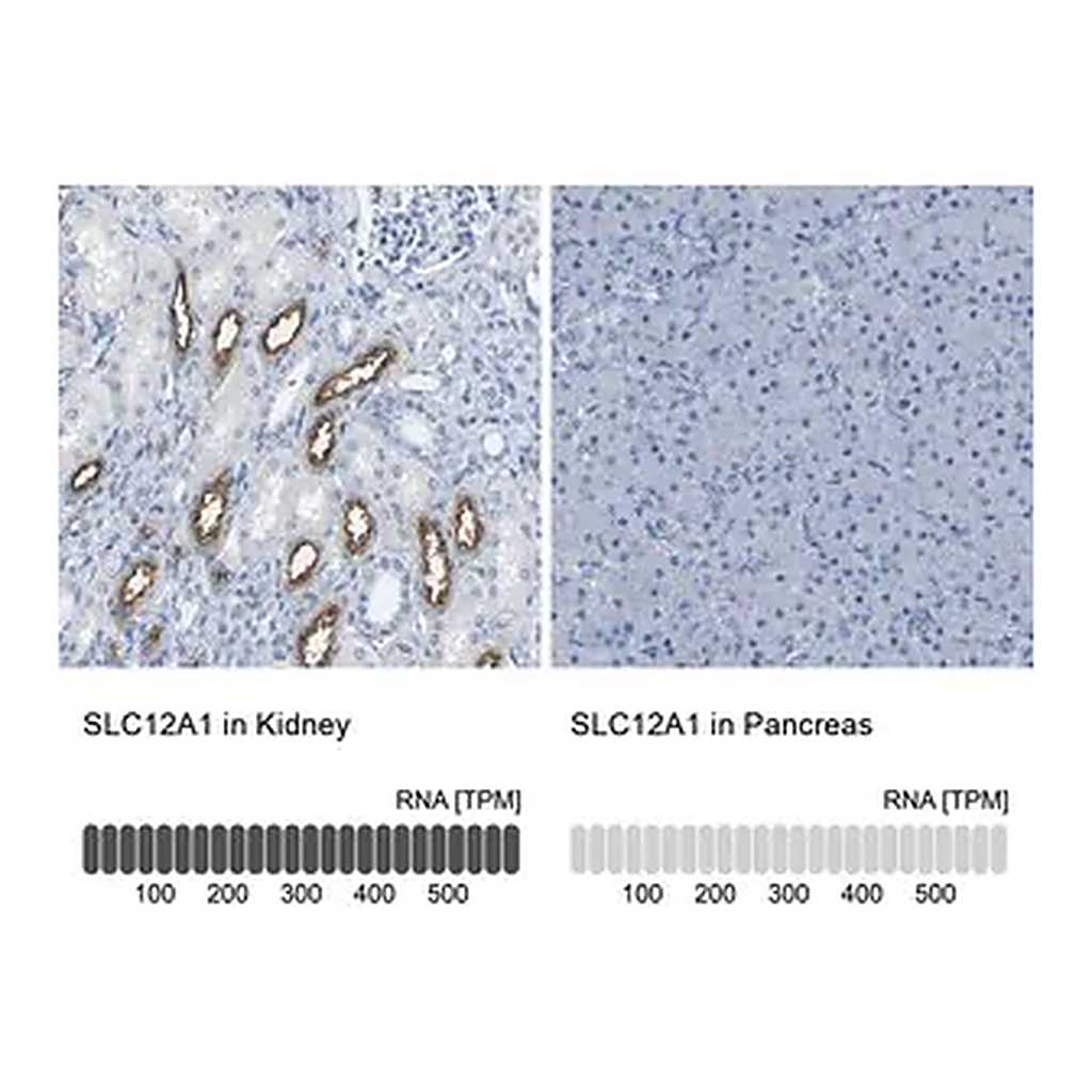 Merck Anti-SLC12A1 antibody produced in rabbit