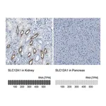 Merck Anti-SLC12A1 antibody produced in rabbit