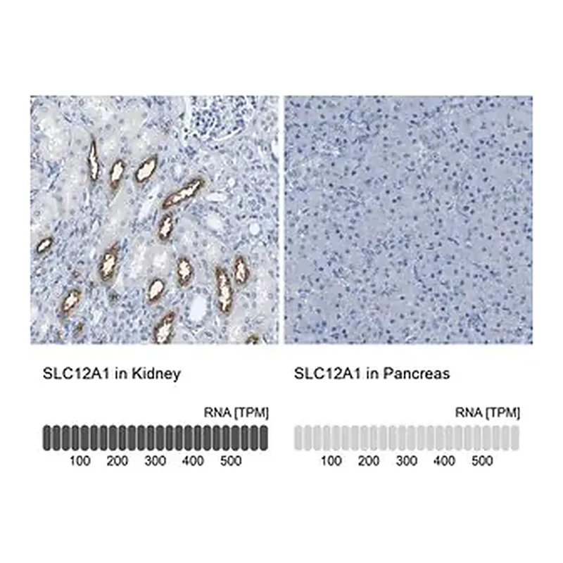 Merck Anti-SLC12A1 antibody produced in rabbit