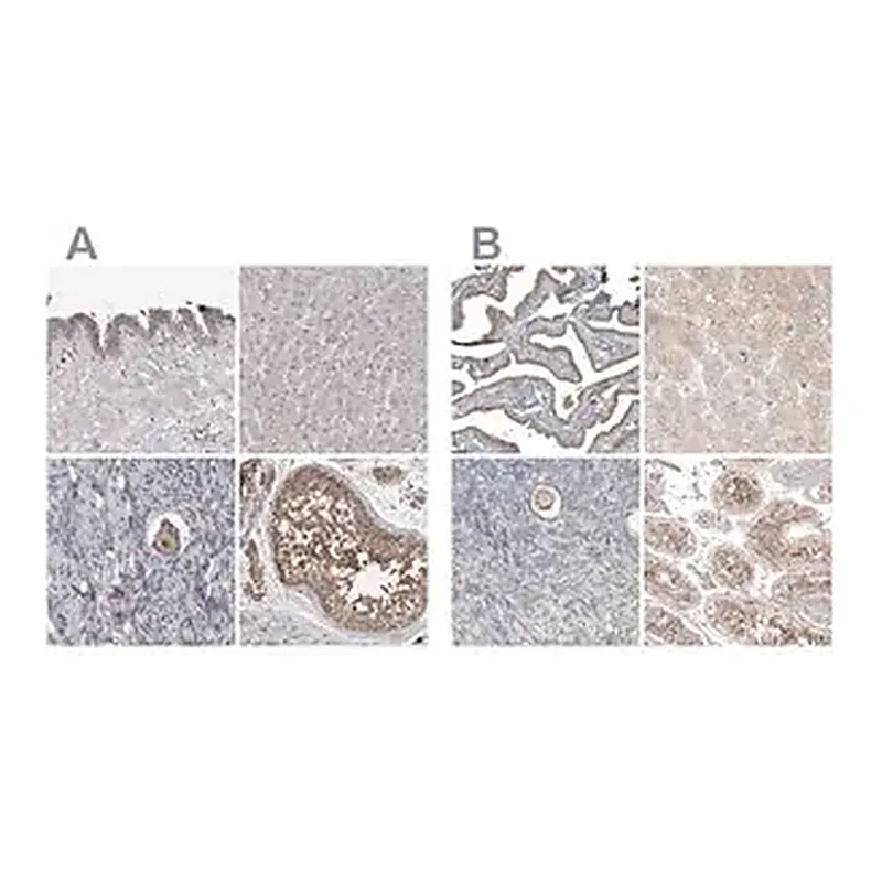 Merck Anti-PCM1 antibody produced in rabbit