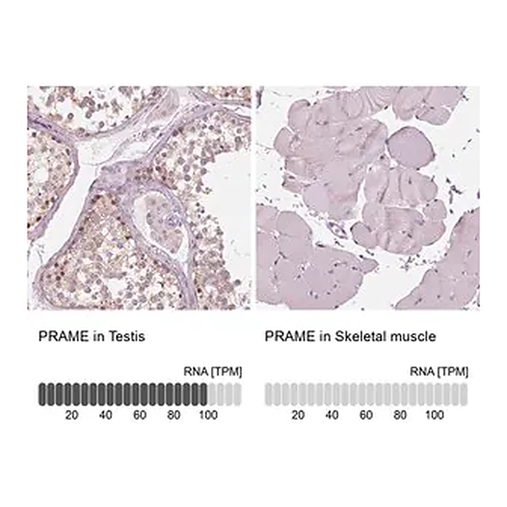 Merck Anti-PRAME antibody produced in rabbit