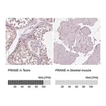 Merck Anti-PRAME antibody produced in rabbit