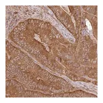 Merck Anti-GSPT1 antibody produced in rabbit