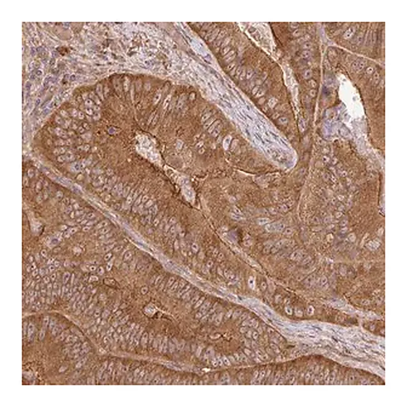 Merck Anti-GSPT1 antibody produced in rabbit