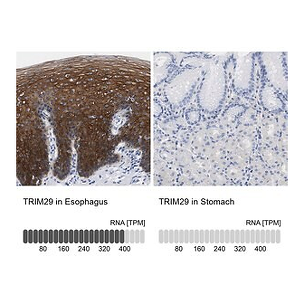 Merck Anti-TRIM29 antibody produced in rabbit