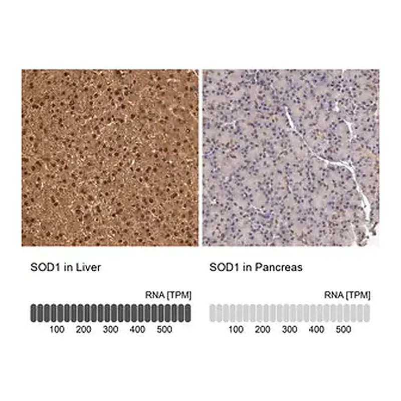 Merck Anti-SOD1 antibody produced in rabbit