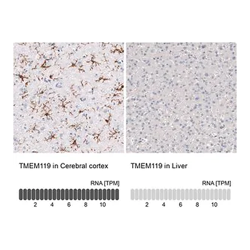 Merck Monoclonal Anti-TMEM119 antibody produced in mouse