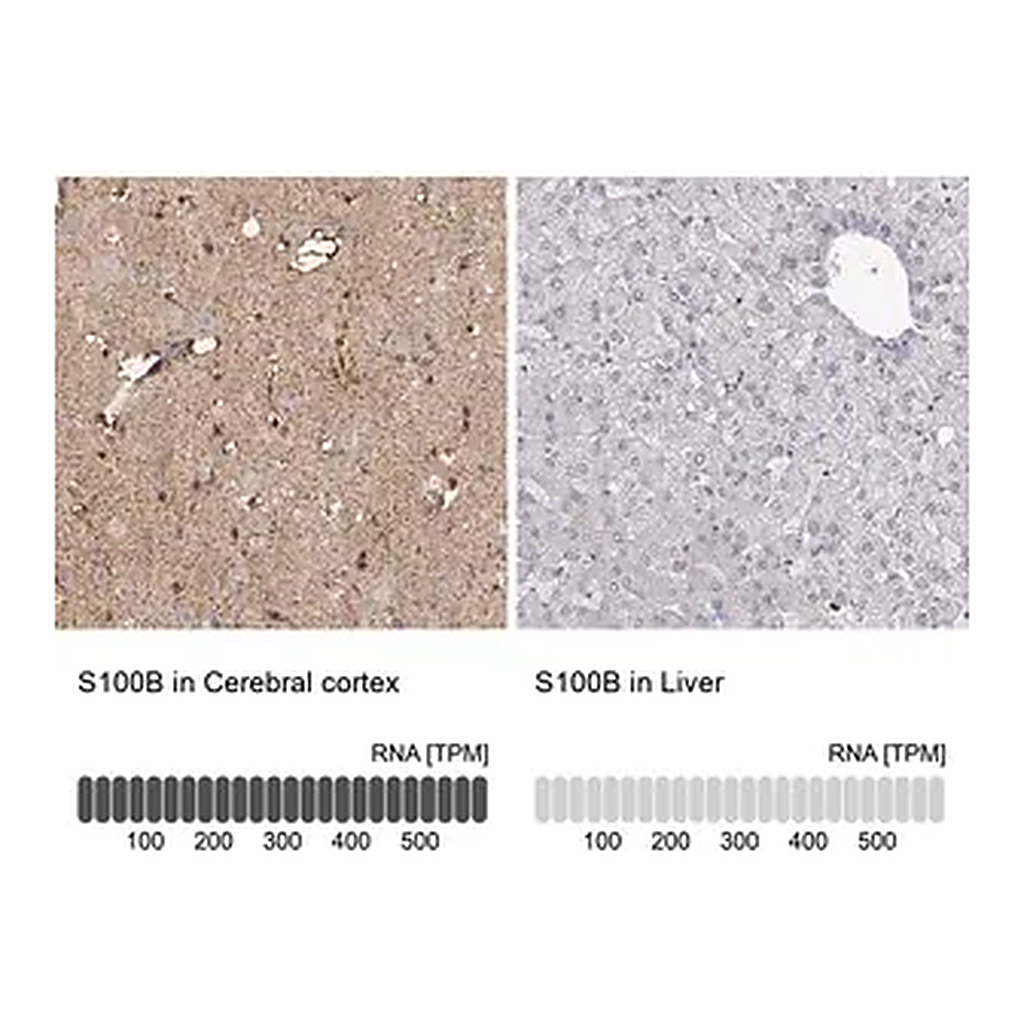 Merck Anti-S100B antibody produced in rabbit