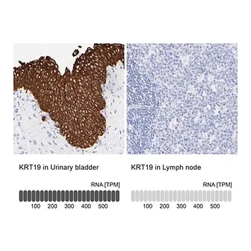 Merck Anti-KRT19 antibody produced in rabbit