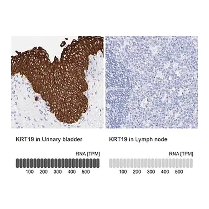 Merck Anti-KRT19 antibody produced in rabbit