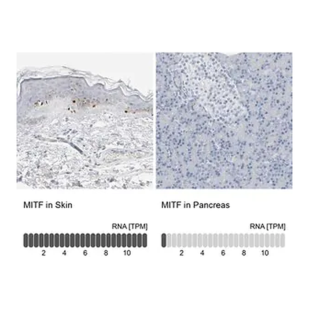Merck Anti-MITF antibody produced in rabbit