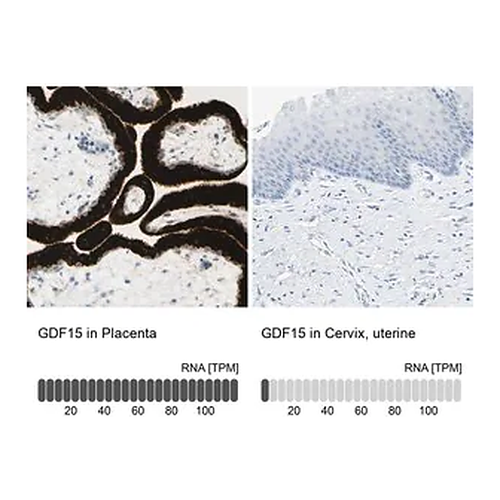Merck Anti-GDF15 antibody produced in rabbit