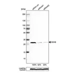 Merck Anti-SDHB antibody produced in rabbit