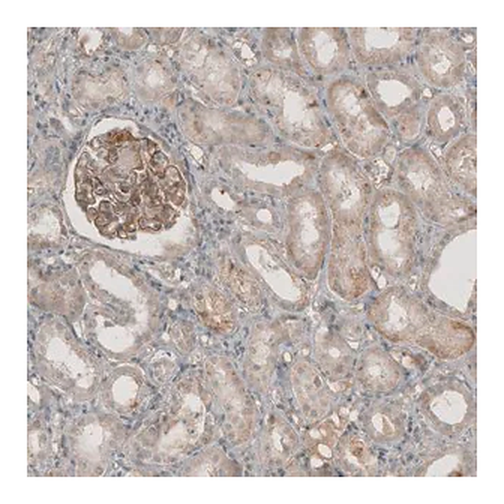 Merck Anti-THSD7A antibody produced in rabbit
