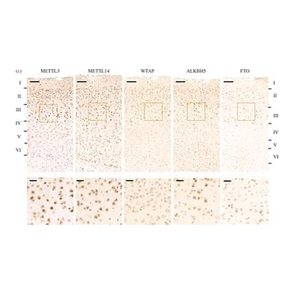 Merck Anti-ALKBH5 antibody produced in rabbit