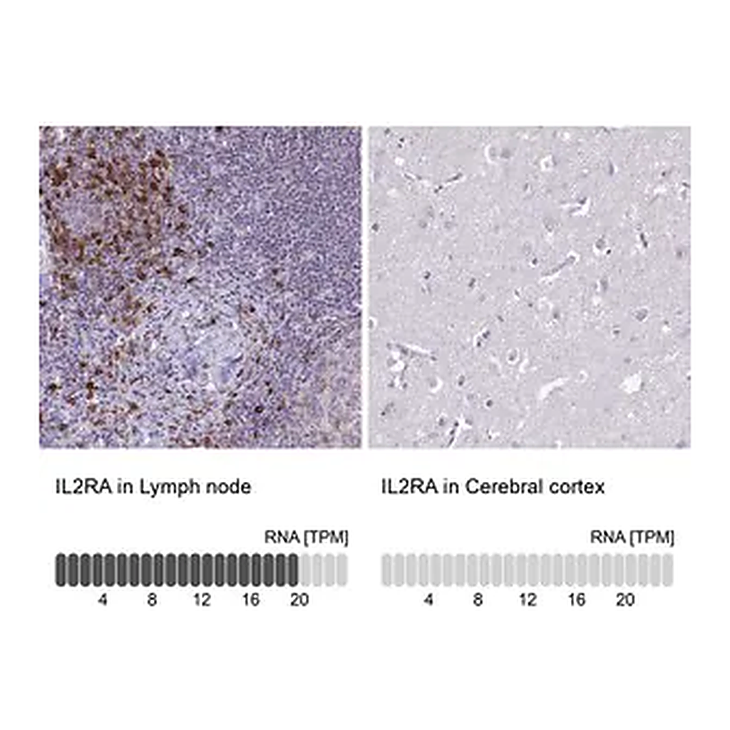 Merck Anti-IL2RA antibody produced in rabbit