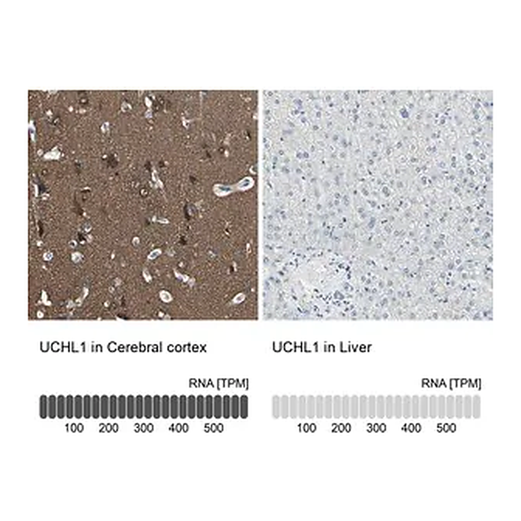 Merck Anti-UCHL1 antibody produced in rabbit