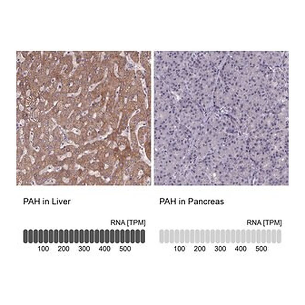 Merck Anti-PAH antibody produced in rabbit