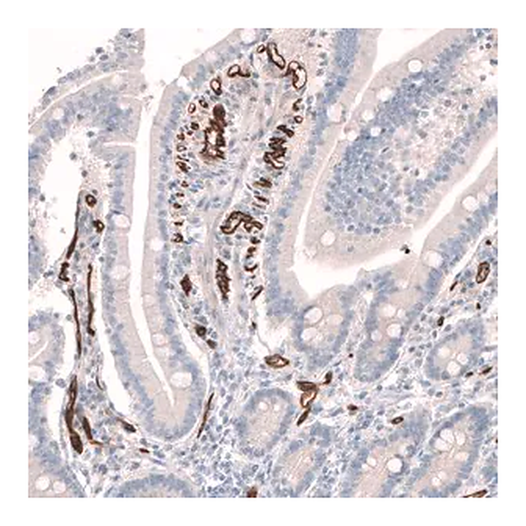 Merck Anti-PLVAP antibody produced in rabbit