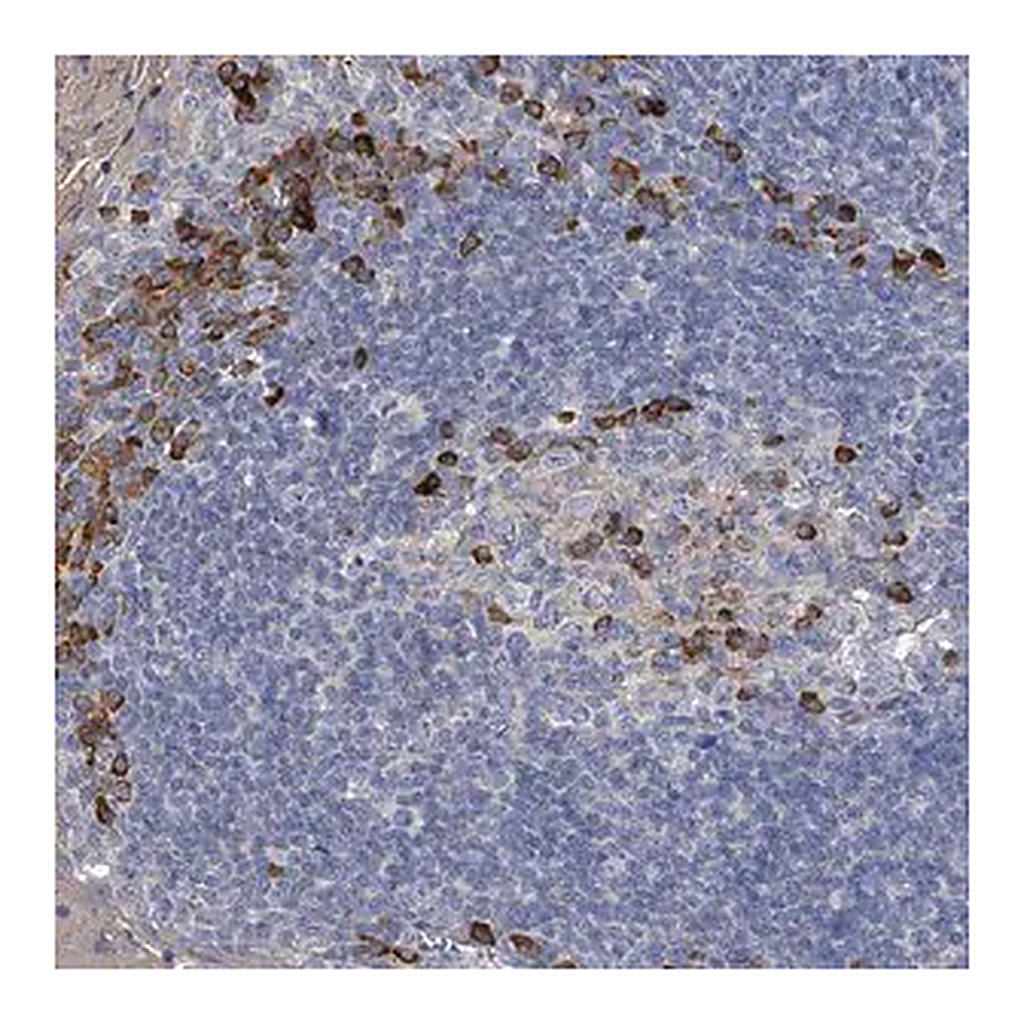 Merck Anti-CCR4 antibody produced in rabbit