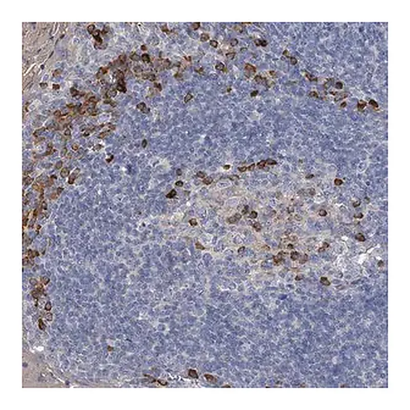 Merck Anti-CCR4 antibody produced in rabbit