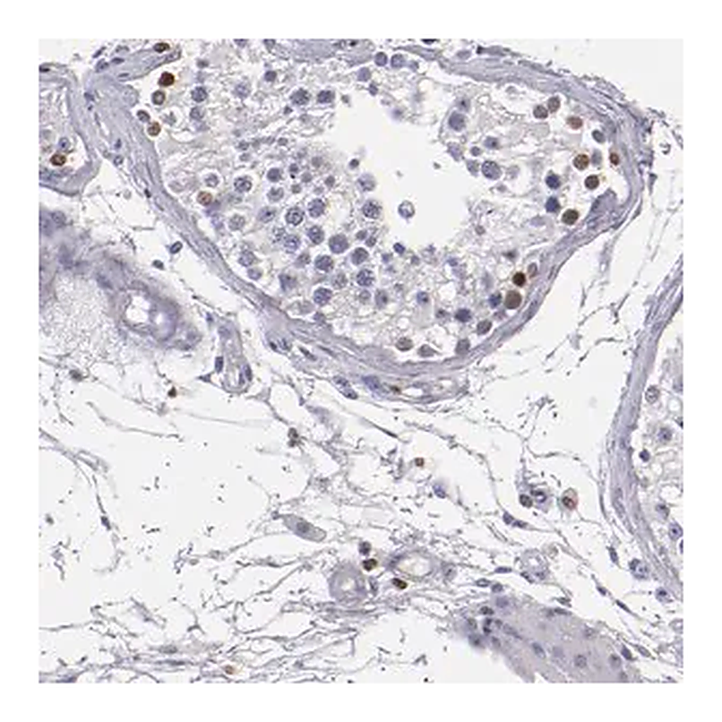Merck Anti-CDKL5 antibody produced in rabbit