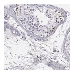 Merck Anti-CDKL5 antibody produced in rabbit