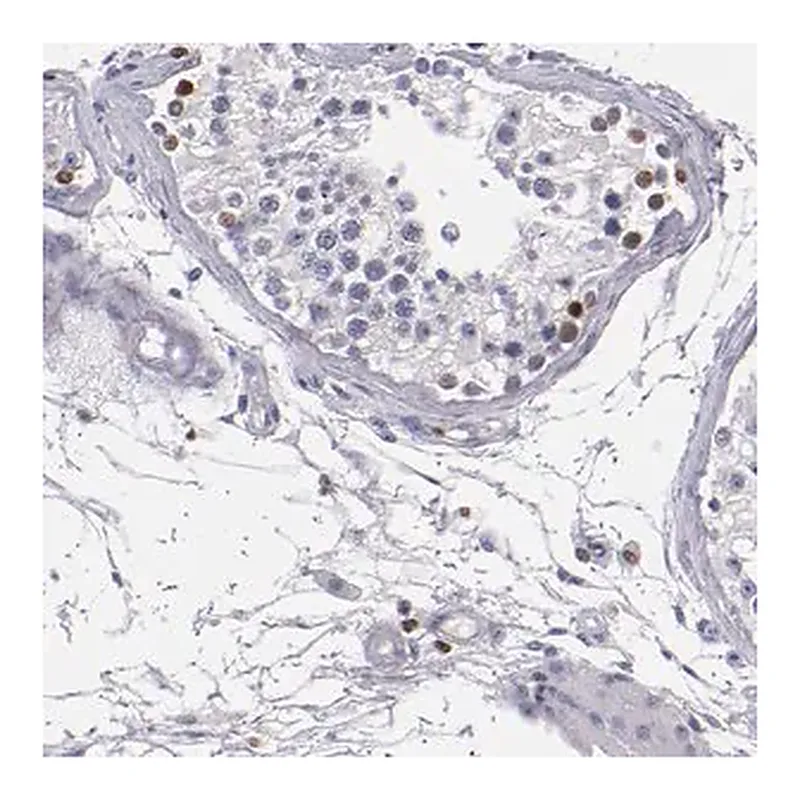 Merck Anti-CDKL5 antibody produced in rabbit
