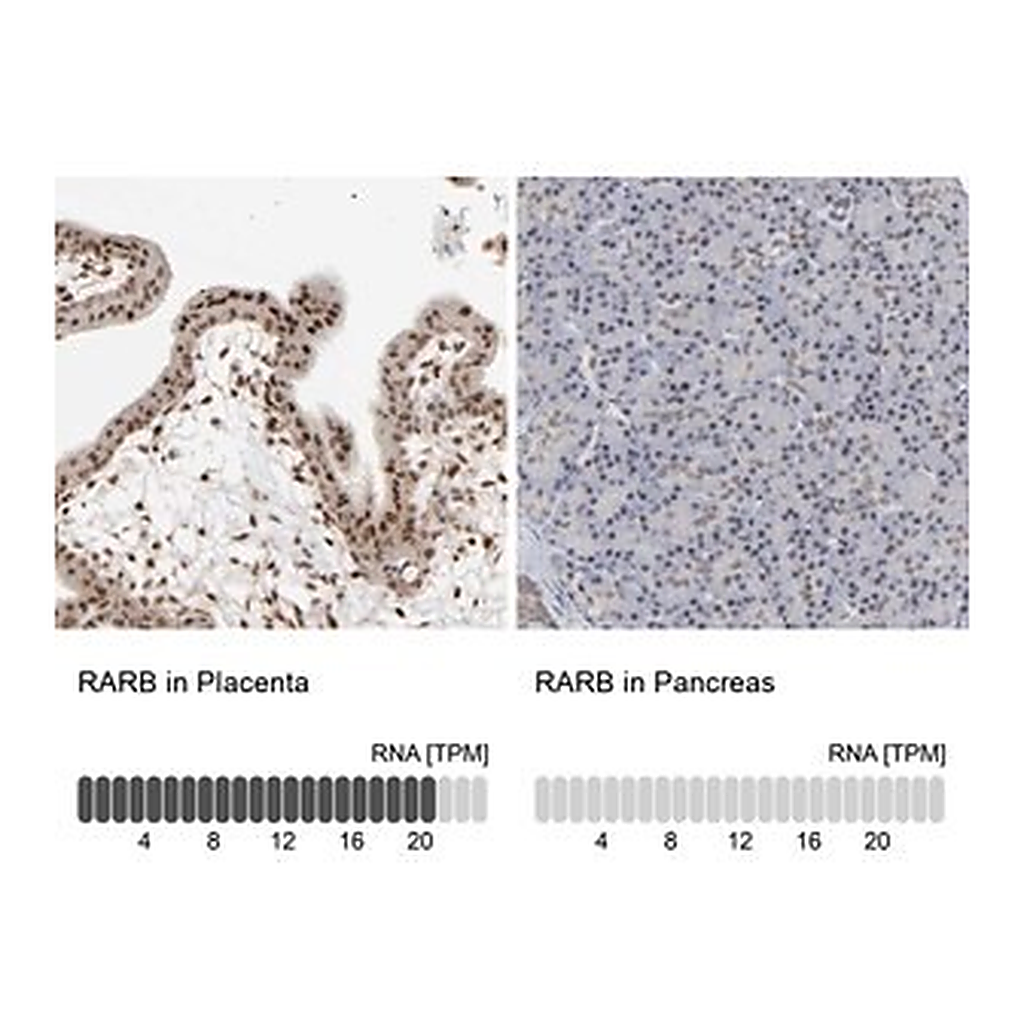 Merck Anti-RARB antibody produced in rabbit