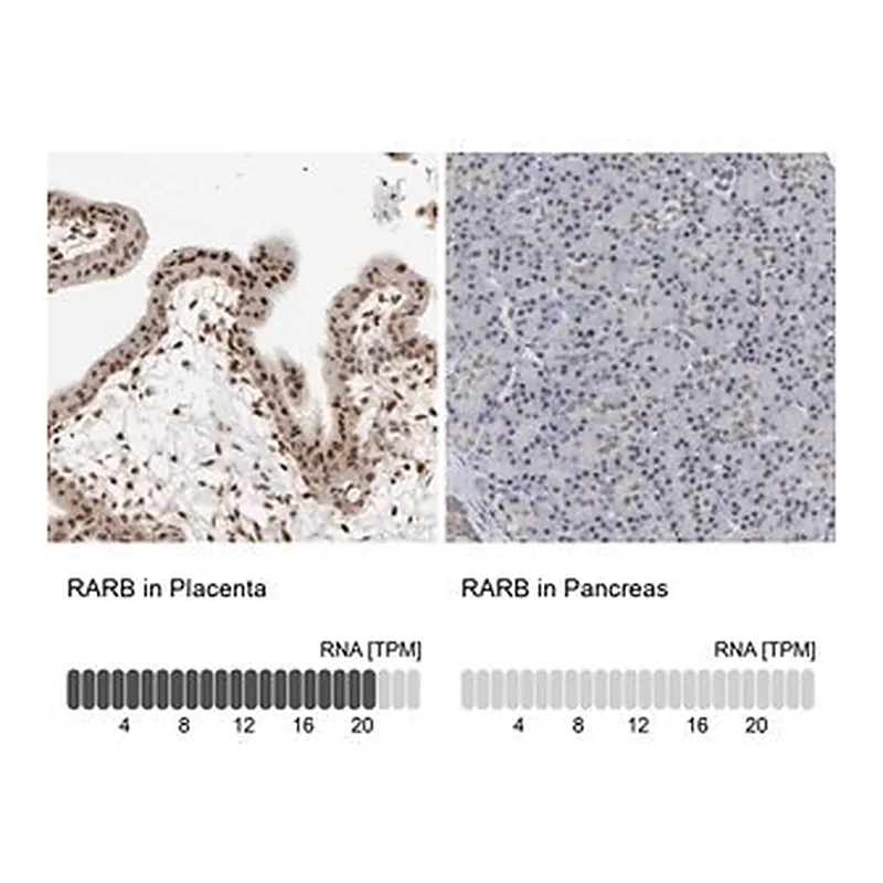 Merck Anti-RARB antibody produced in rabbit