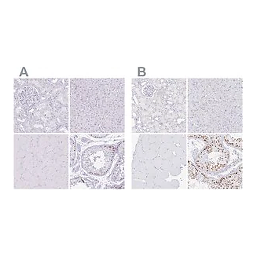 Merck Anti-CXorf67 antibody produced in rabbit