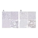 Merck Anti-CXorf67 antibody produced in rabbit