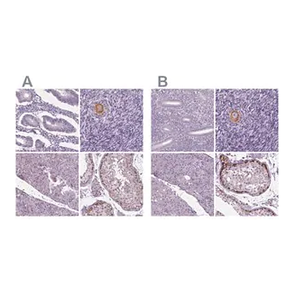 Merck Anti-IGF2BP1 antibody produced in rabbit