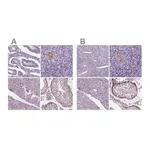 Merck Anti-IGF2BP1 antibody produced in rabbit